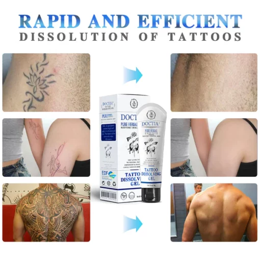 Doctia™ Tattoo Removal Cream - Image 6