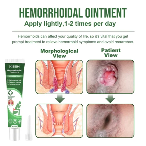 KISSHI™ Hemorrhoidal Ointment - Image 5