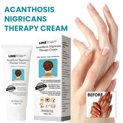 LIMETOW™ Acanthosis Nigricans Therapiecreme