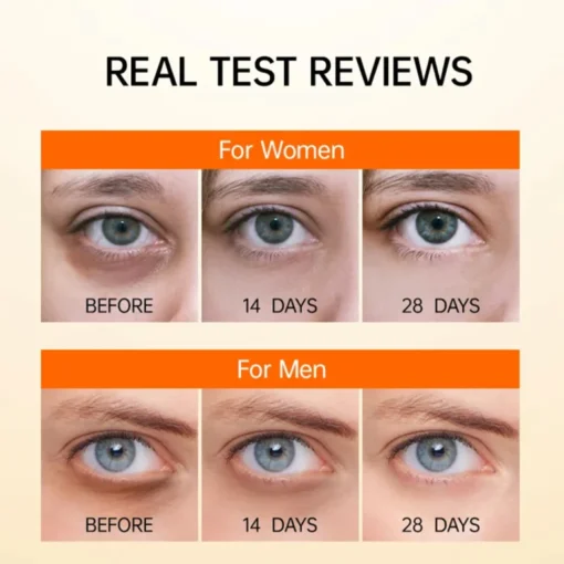 EYEPLUS™ Vitamin C Depuffing Eye Serum - Image 7