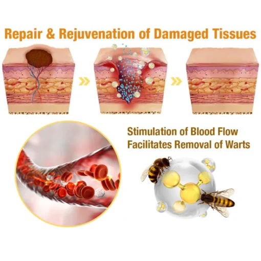 flysmus™ TagRecede Bee Venom Treatment Spray - Image 6