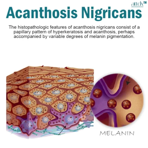 ATTDX ClearSkin Acanthosis Nigricans Therapy Cream - Image 7