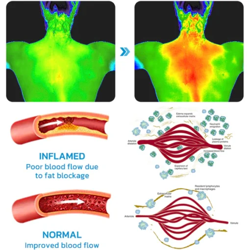 Seurico™ Akupunkturpunkte LymphoCalming NeckInstrument - Image 3