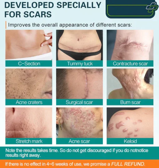 SCARGone™ Advanced Scar Spray - Image 6