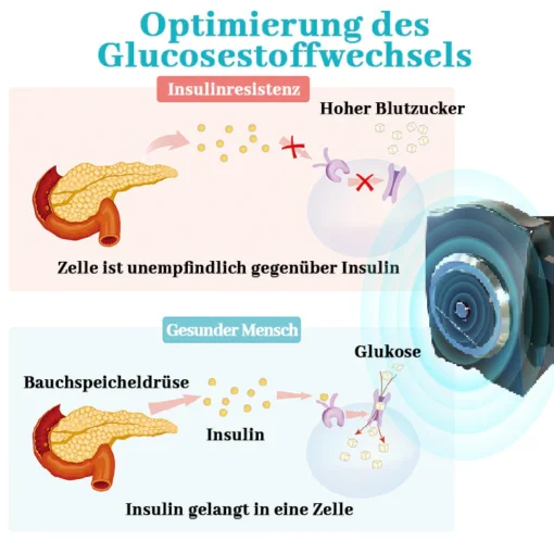 Biancat™ GylcoNova Elektrisches Pulsgerät - Image 3