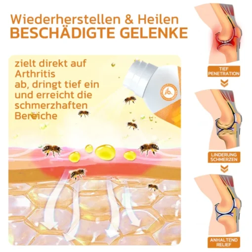 GFOUK™ Bienengift Gelenk- und Knochentherapie Spray - Image 4