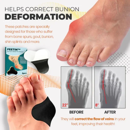 Bunion Relief Fit Patch - Image 7