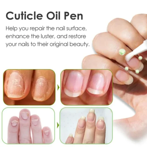 Seurico™ Nail Nutrient Cuticle Oil Pen - Image 4