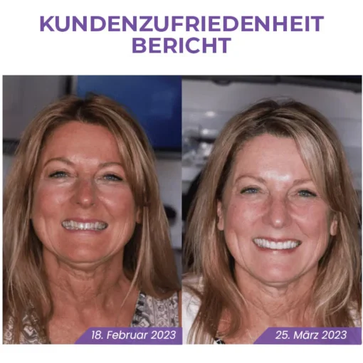 Fivfivgo™ Rein pflanzliches Zahnweiß-Mousse - Image 9