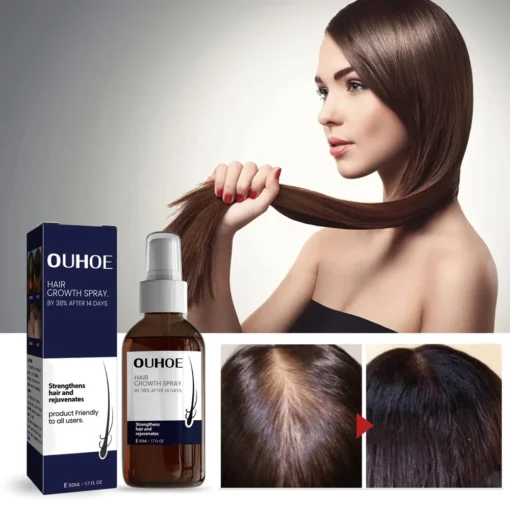 OUHOE Natural Hair Regrowth Spray