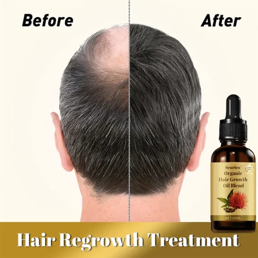 Seurico™ Organic hair growth oil blend - Image 8