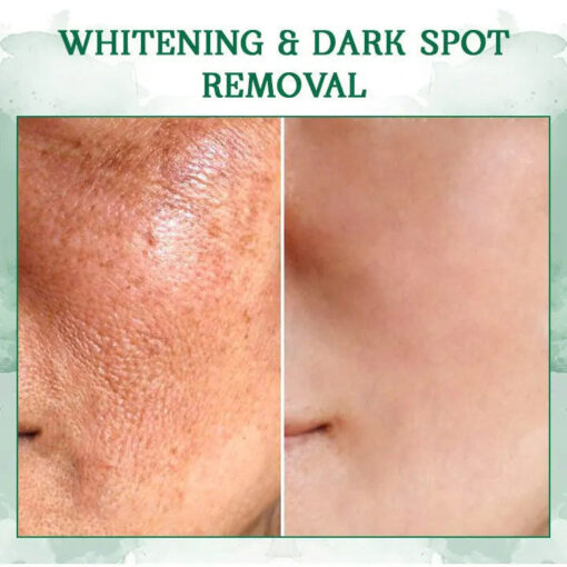 Oveallgo™ SkinFirming Rejuvenating Serum - Image 4