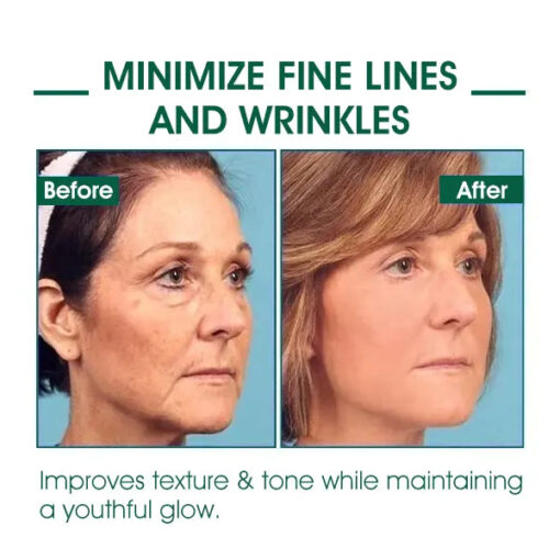 Oveallgo™ SkinFirming Rejuvenating Serum - Image 3