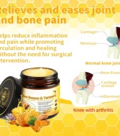 Lotmay™ Bee Venom & Turmeric Arthritis Treatment Cream