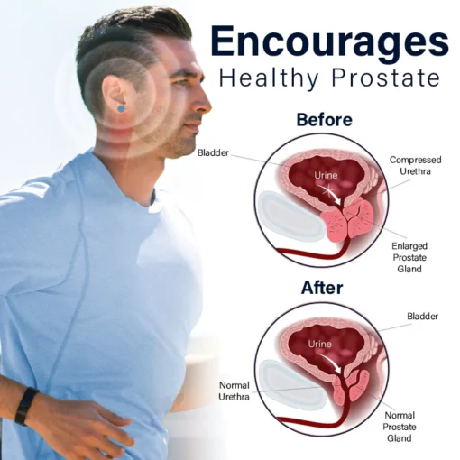 Miniyou™ Magnetherapy Prostate Wellness Earring - Image 4