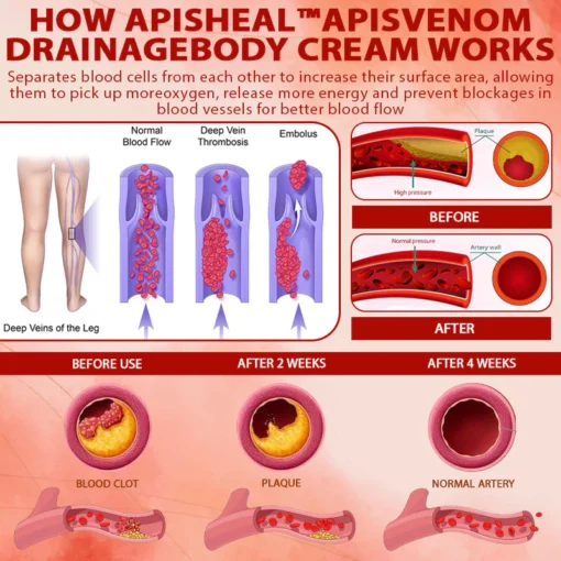 ApisHeal™ ApisVenom EdemaSupport Lymphatic Detox Cream - Image 6